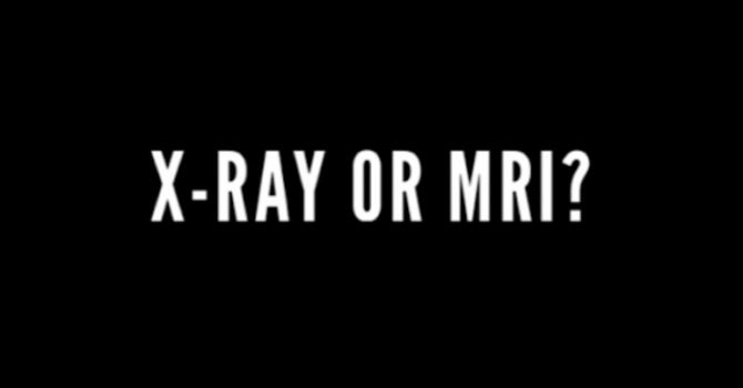 Do You Need an X-Ray or MRI Before You Get Physiotherapy? image